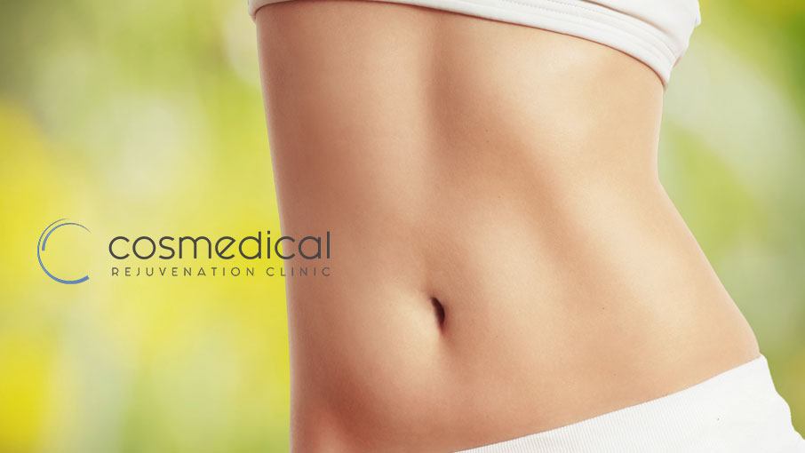 tummy tuck toronto