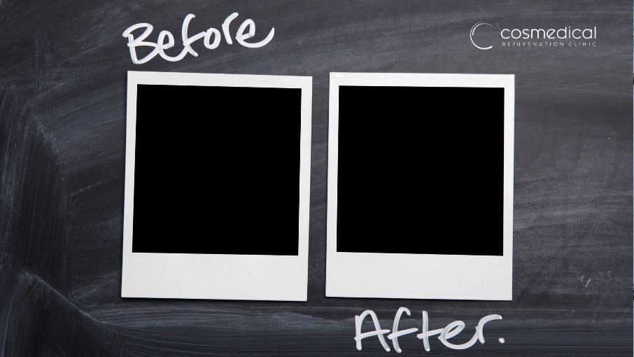 before and after