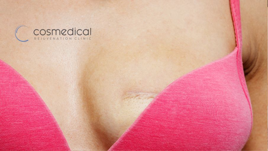 woman putting cream on chest