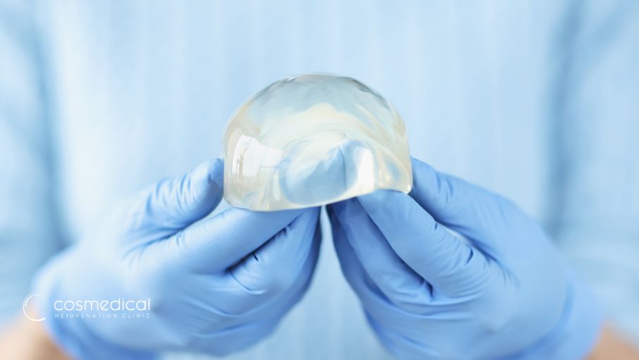 breast implants