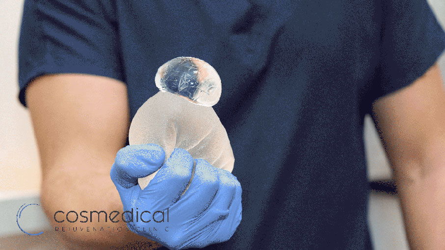 ruptured breast implant