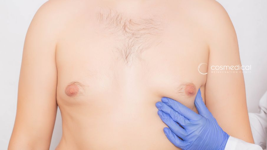 male chest