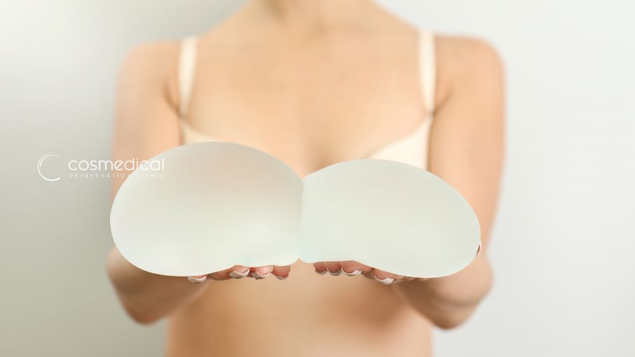 breast implants