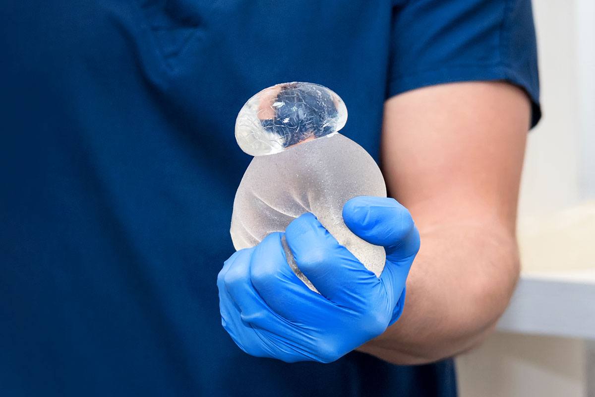 silicone breast implant rupture