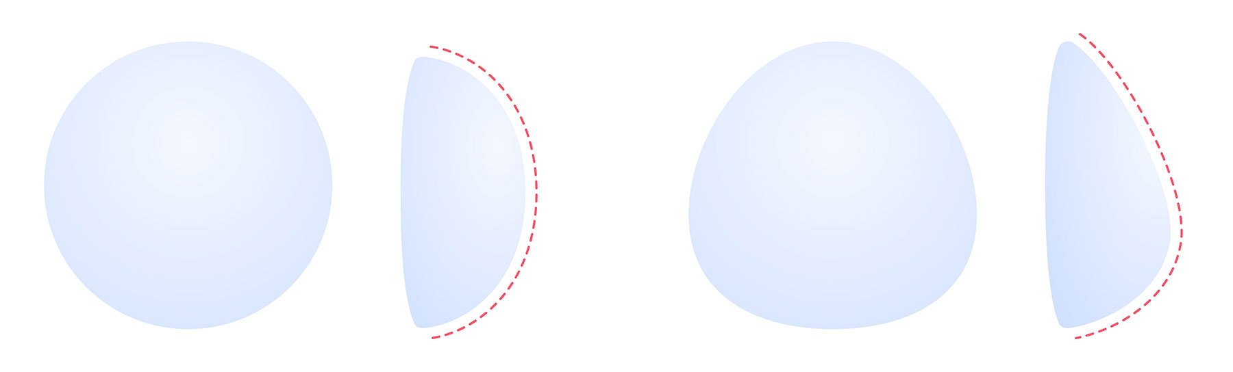 breast implant shapes