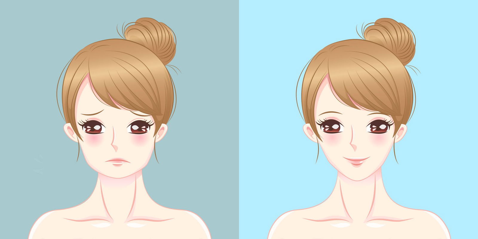 buccal fat pad before and after