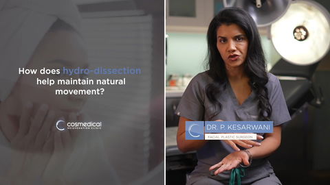 Facelift Patient Results - Patient 3