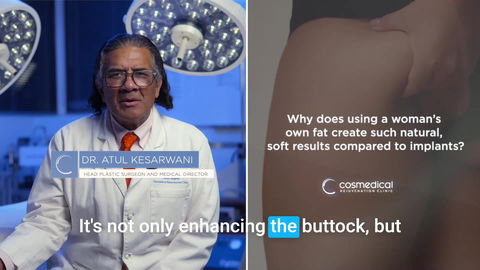 Fat Transfer Breast Augmentation Results