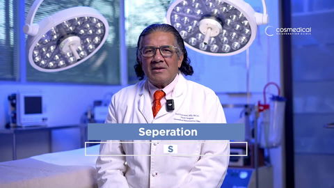 Liposuction Patient Results - Patient 3