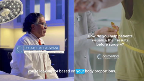 Breast Augmentation with Implants - Patient 1