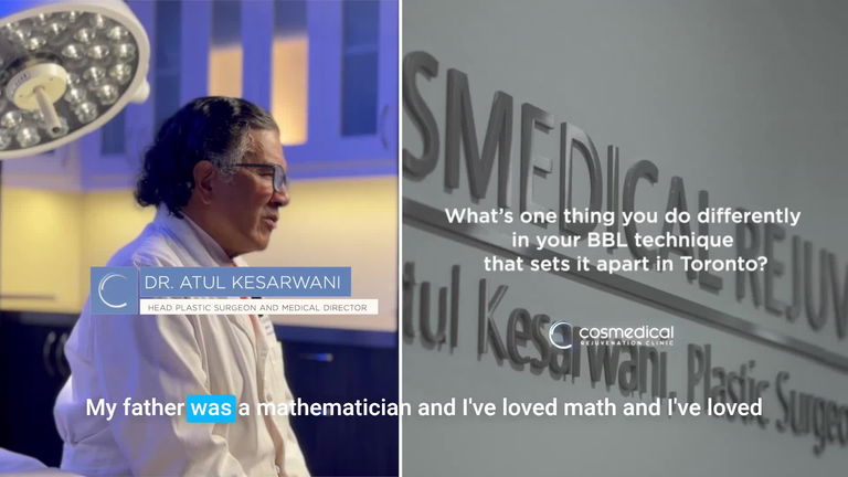 Brazilian Butt Lift Before and After - Patient 2